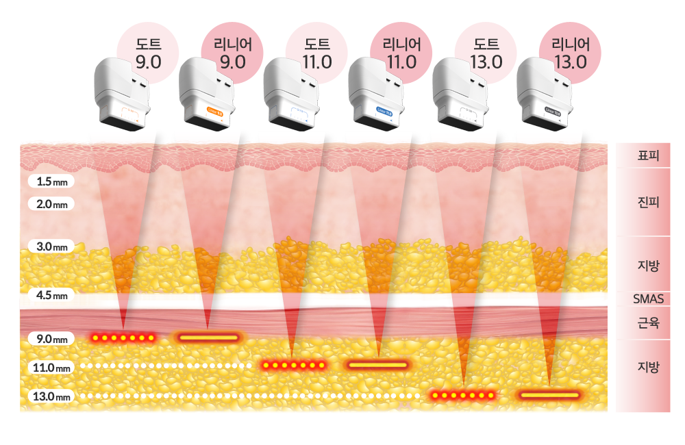 카트리지별 에너지전달 피부층