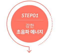 step1 집속형 초음파 에너지